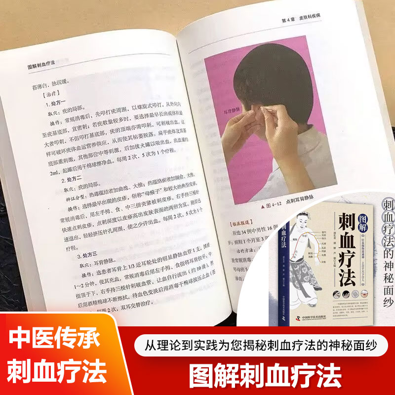 혈액 배출 요법에 대한 설명: 건강과 웰빙 관리 및 의 - Therapy Health And Wellness 리뷰 및 가격